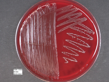 picture of Enterococcus faecium (DSM 17050) on agar plate